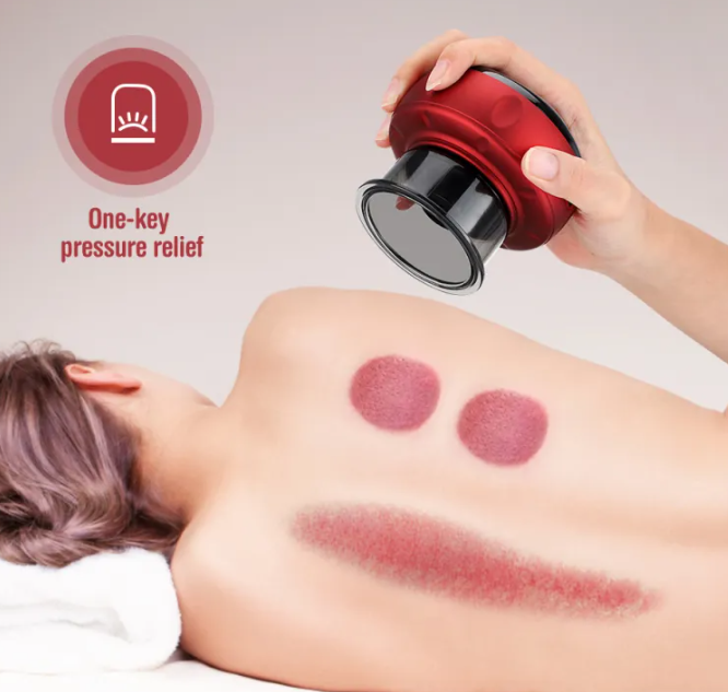 Electric Cupping Massager